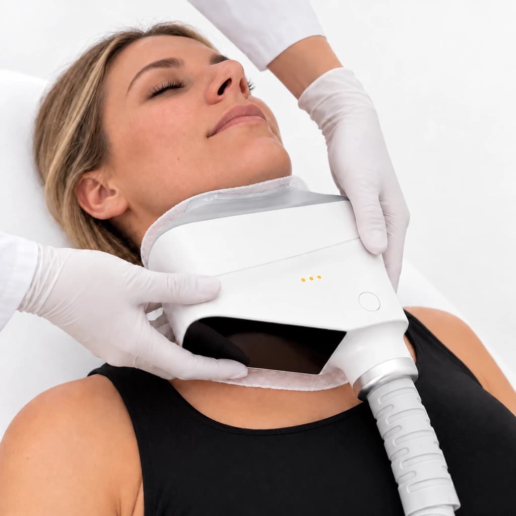 CRYOCOOL submental treatment